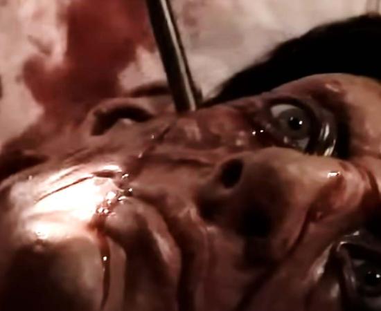 King Henry V arrow removal surgery recreation. Source: YouTube Screenshot / thehistorysquad.